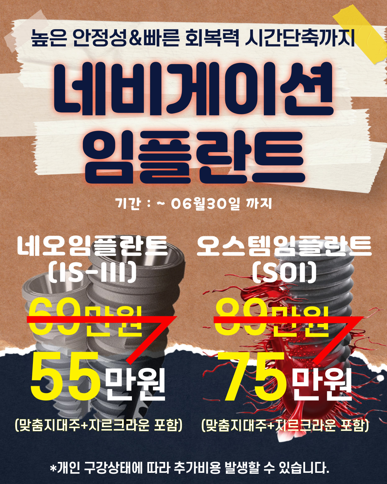 팝업2
